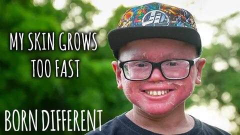 Fast born
