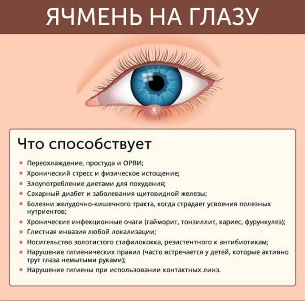 Значение правого глаза. Я чмень на глощу. Ячмень на глазу внутреннее веко.