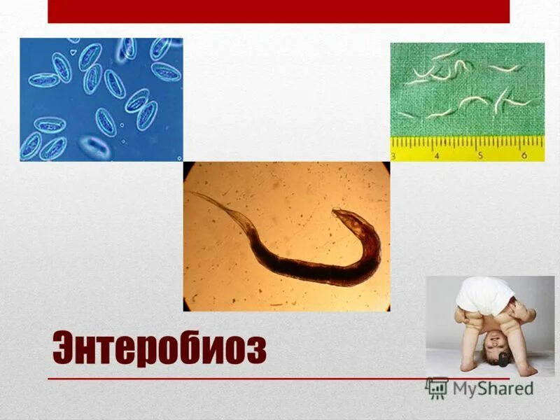 Через энтеробиоз. Метод диагностики энтеробиоза. энтеробиоз вызывается заражением. алиментарный энтеробиоз.
