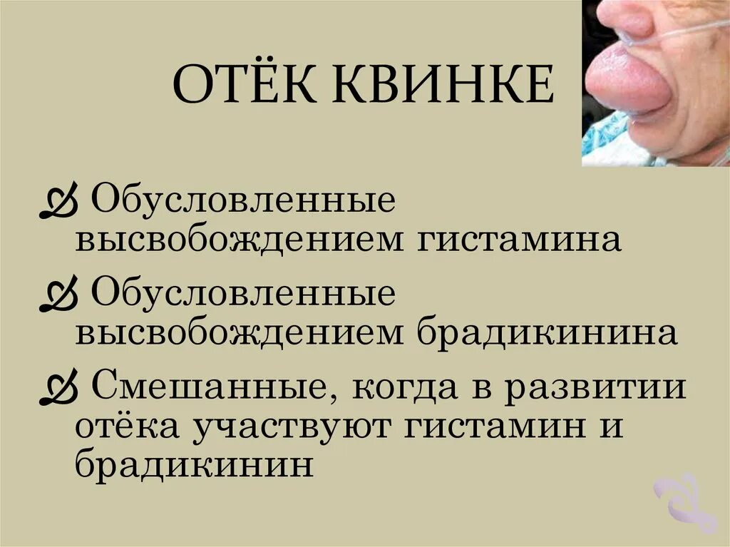 Алгоритм при отеке квинке. Предпосылки отека Квинке.