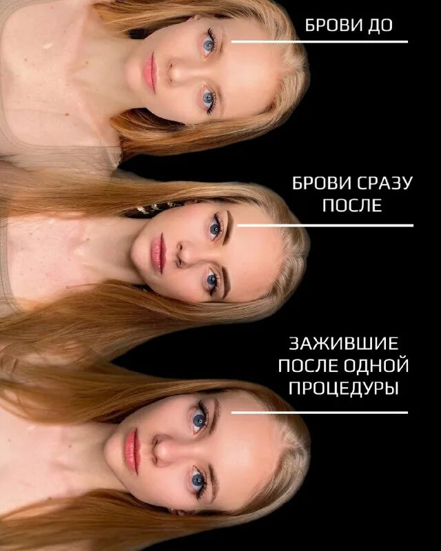 форма губ анджелины джоли. увеличение губ форма джоли. меган фокс до и после пластики. девушка без макияжа. красивый макияж до и после.