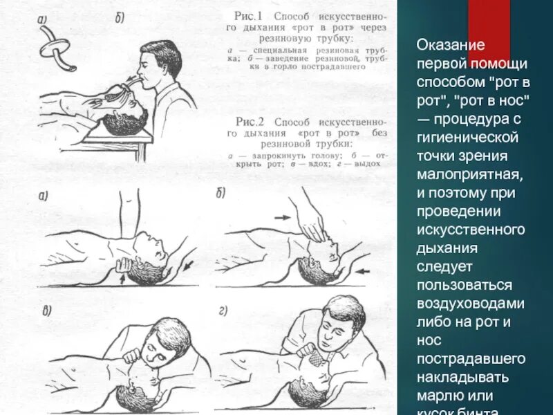 Эффективное искусственное дыхание. Способы искусственного дыхания. Воздуховод для проведения искусственного дыхания. Искусственное дыхание ошибки.