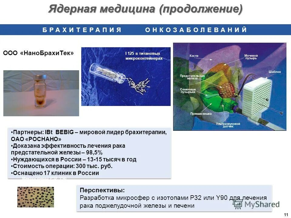 Брахитерапия рака отзывы