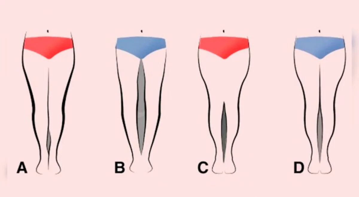 Виды ляшек. Формы женских ног. Идеальная форма ног. Идеальная форма ног у девушек. Ноги с просветом.