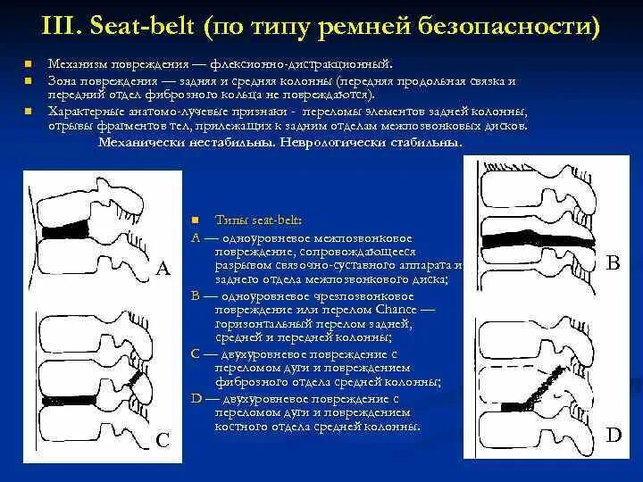 Переломы позвонков классификация АО. Компрессионные переломы тел позвонков классификация. Дистракционный перелом позвоночника. Классификация переломов позвоночника по АО.