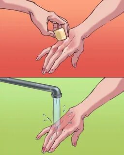 Обжег водой