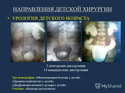 Детская урология хирургия