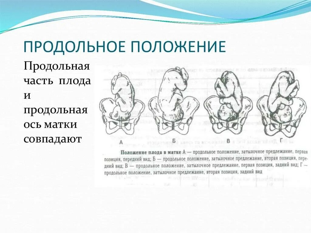 Положения головки плода. Положение плода продольное головное 2 позиция. Положение плода продольное предлежание головное. Положение плода продольное тазовое 1 позиция. Продольное положение тазовое предлежание 30 недель.