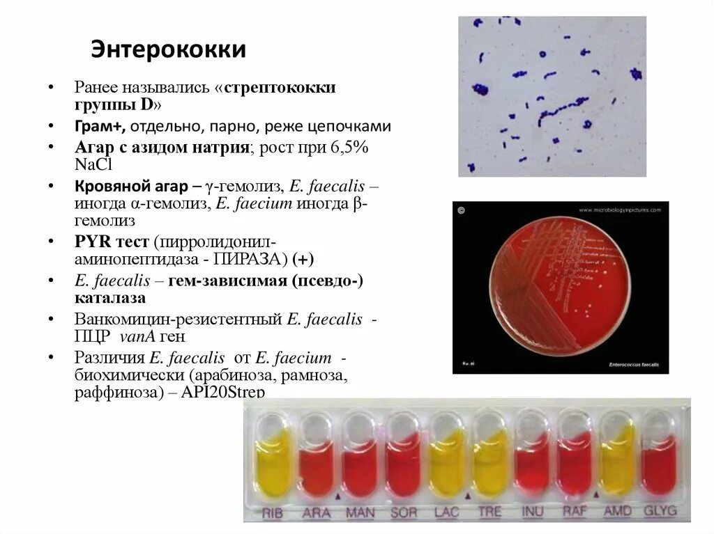 Стрептококки у женщин лечение. Enterococcus faecalis культуральные свойства. Энтерококки микробиология заболевания. Энтерококки на питательных средах. Энтерококки микробиология диагностика.