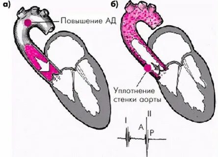 Что значит уплотнить