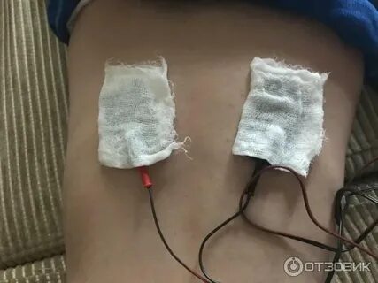 Электрофорез по разбитым