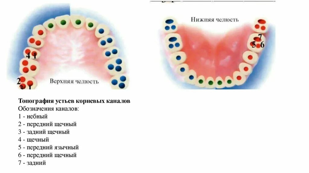 Схема устьев корневых каналов зубов. Топография каналов зубов верхней и нижней челюсти. Расположение корневых каналов в зубах. Топография устьев корневых каналов зубов.