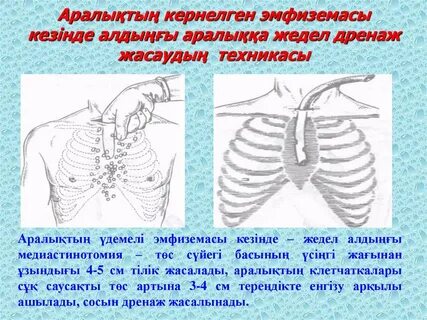 Порно русски не супершени летни