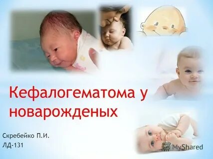 Новорожденные реферат