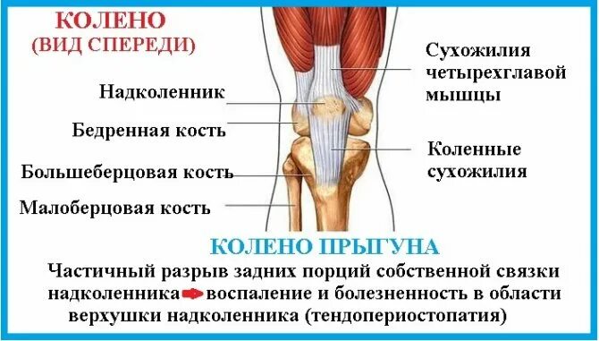 Воспаление коленных связок лечение. Связки и сухожилия надколенника. Тендинит сухожилия собственной связки надколенника. Колено прыгуна тендинит надколенника. Тендинит сухожилия подколенной мышцы.
