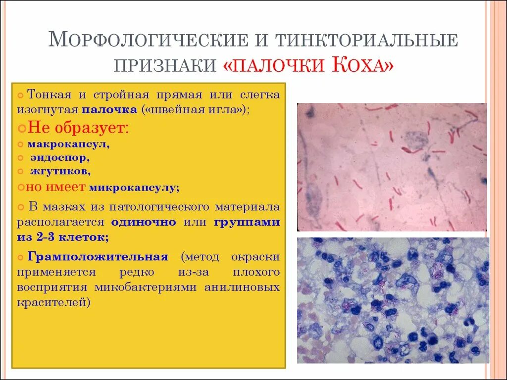 Признак палочки. Тинкториальные свойства синегнойной палочки. тинкториальные признаки. морфологические и тинкториальные.