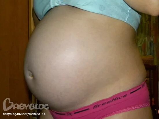 33 недели после. Растяжки на животе на 32 неделе. Растяжки на животе 40 неделя. Живот на 33 неделе беременности мальчиком.
