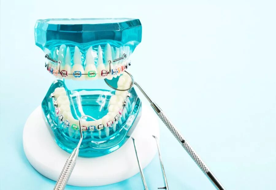 Мрт можно делать с брекетами на зубах. Ортодонтия в стоматологии. Ортодонтические конструкции. Ортодонтическая модель зубов. Инструменты для брекетов стоматология.