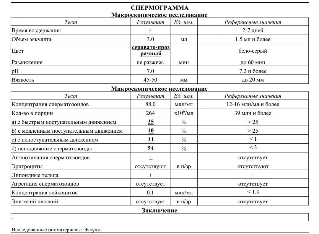 После второго полового акта. Концентрация сперматозоидов в 1 мл эякулята в норме. Спермограмма объем больше 10 мл. Спермограмма микроскопия. Спермограмма таблица нормальная.