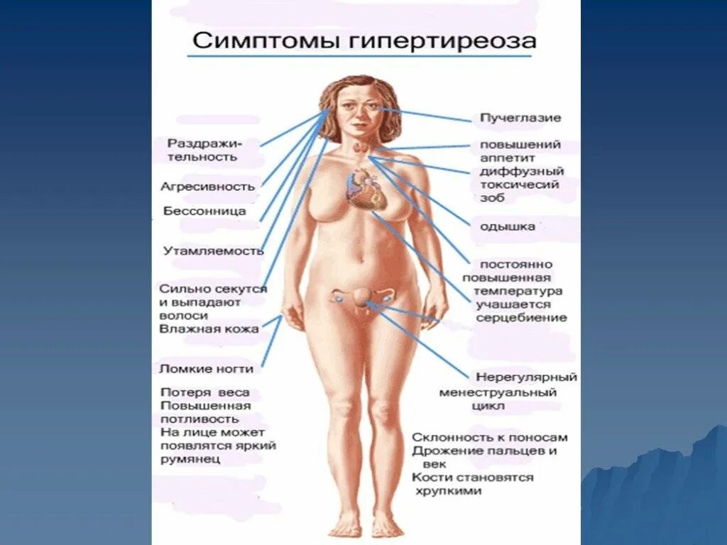 Что значит зоб. Половая система при гипертиреозе. Клинические проявления при гипотиреозе и гипертиреозе. Заболевания щитовидной железы (гипертиреоз, тиреотоксикоз)..