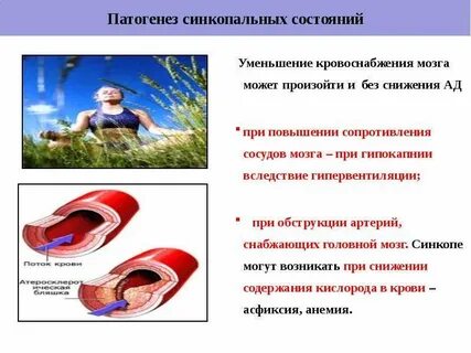Острая сосудистая недостаточность презентация
