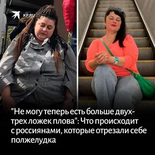 Бариатрическая операция в новосибирске