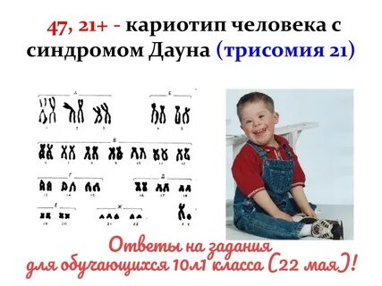 Кариотип больных людей