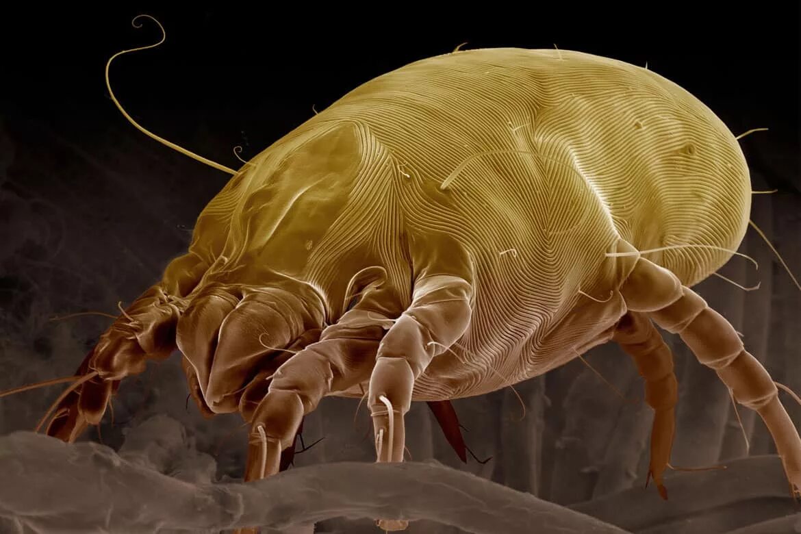 Бактерии клещей. Клещ Dermatophagoides pteronyssinus. Сапрофиты бельевые клещи. Сапрофиты пылевые клещи. Клещ сапрофит под микроскопом.