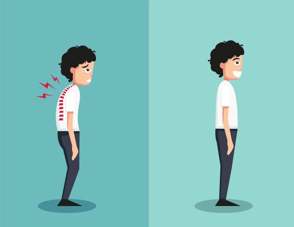 Часто и неправильная. Часто и неправильная. Осанка мультяшная. Сгорбленная осанка. Осанка.