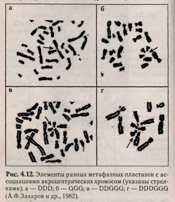 Кариотип мыши. Хромосомы мыши. Изучение метафазных пластинок клеток человека в норме. Женский кариотип с 45 хромосомами и робертсоновской транслокацией. Кариотип крысы.