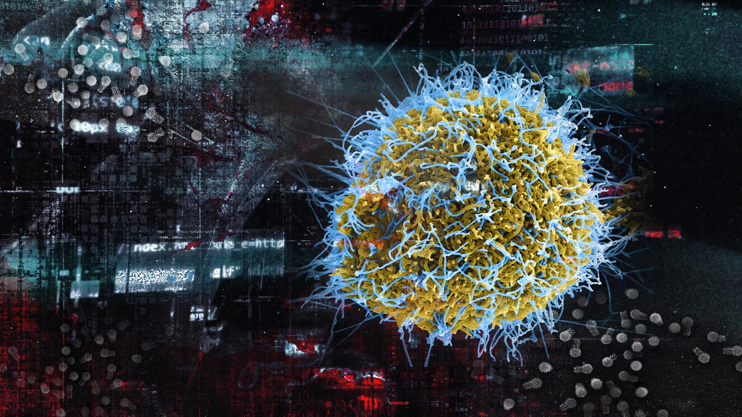 Атипичная пневмония у взрослых. Атипичная пневмония вирус sars. атипичная пневмония (sars). sars атипичная пневмония 2002. атипичная пневмония строение вируса.