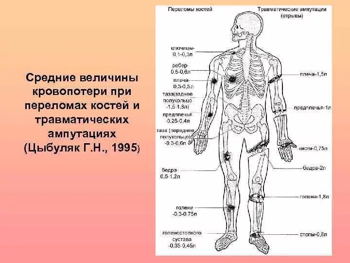Кровопотери при переломах. Кровопотеря при закрытых переломах. средние величины кровопотери при переломах костей. средние величины кровопотери. средние величины кровопотери при переломах костей таблица.