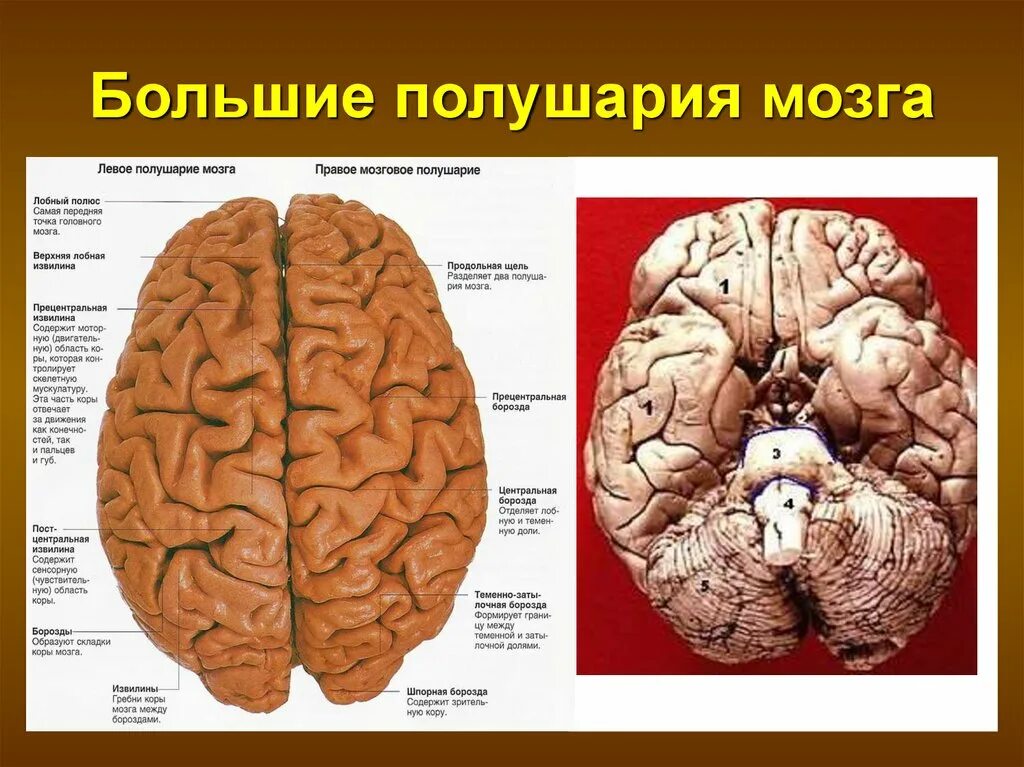 Расположение долей больших полушарий. Полушария мозга. Большие полушария. Полушария большого мозга. Левое полушарие большого мозга.