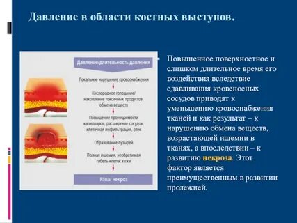 Как лечить пролежни