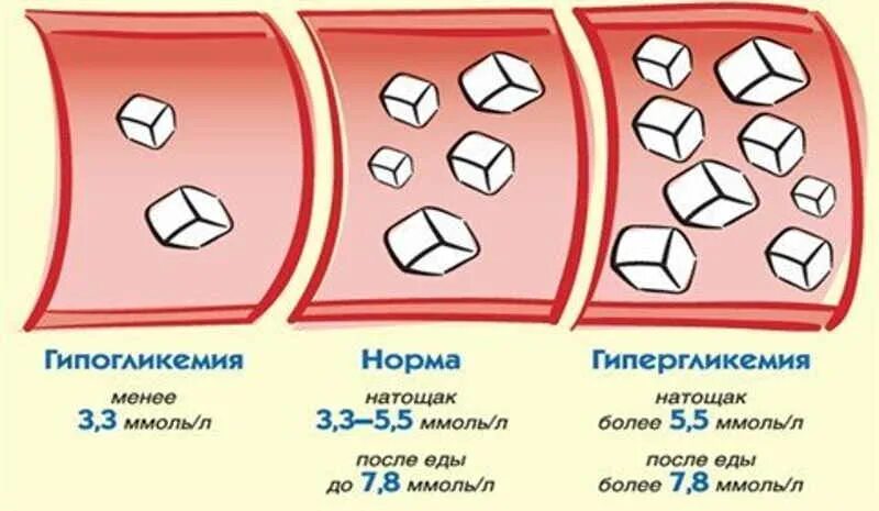 Гипогликемия у здорового человека