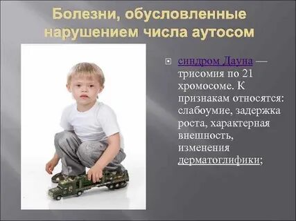 Синдром связанный