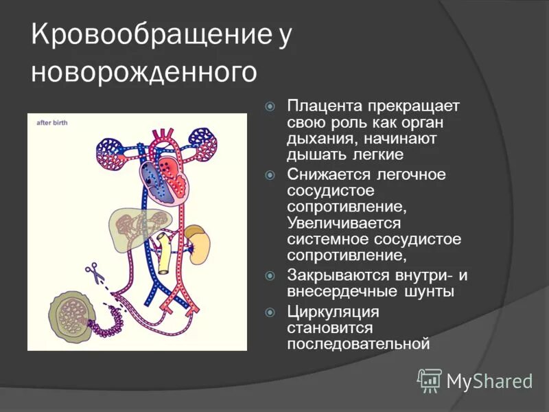 Участие в кровообращении. Кровообращение новорожденного. Круги кровообращения новорожденного. Кровеносная система новорожденного ребенка. Кровообращение плода и новорожденного педиатрия.