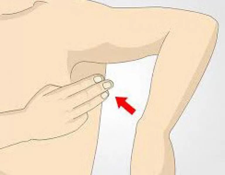 Расположенные под мышками. Где находятся лимфоузлы в подмышках схема у женщин. Подмышечные лимфоузлы воспаление. Подмышечные лимфоузлы фото. Подмышечные лимфоузлы воспаление.