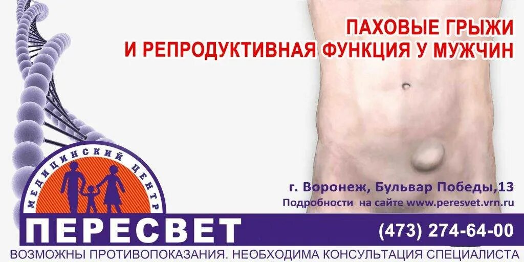Как лечить паховую грыжу у мужчин. Паховая грыжа у мужчин операция. двусторонняя паховая грыжа у мужчин. паховая грыжа у мужчин симптомы.