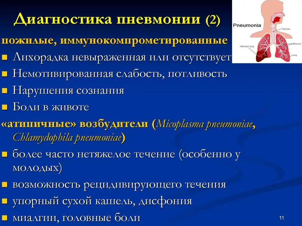 Диагностические критерии атипичных пневмоний. Презентация острая пневмония. Атипичная пневмония диагноз. Какие боли при пневмонии