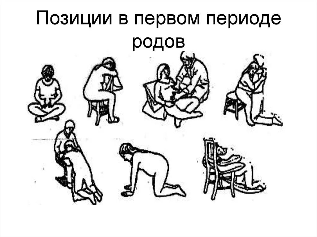 Первые роды этапы. Периоды родов. Позы в первом периоде родов. Первый период родов позиции.