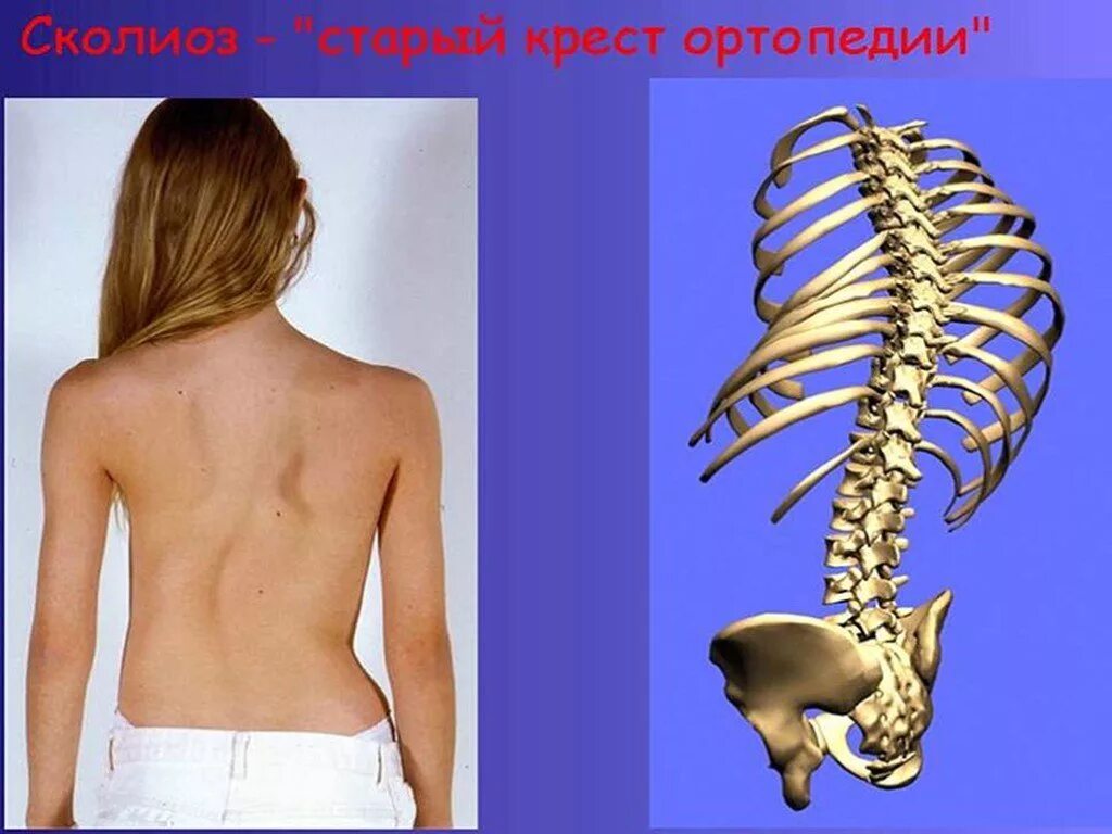 Нарушения развития скелета