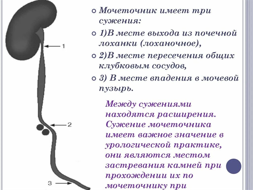 Для мочеточника характерно. Предпузырный отдел мочеточника. Юкставезикальный отдел мочеточника схема. Сужение мочеточника рентген. Строение мочеточника.