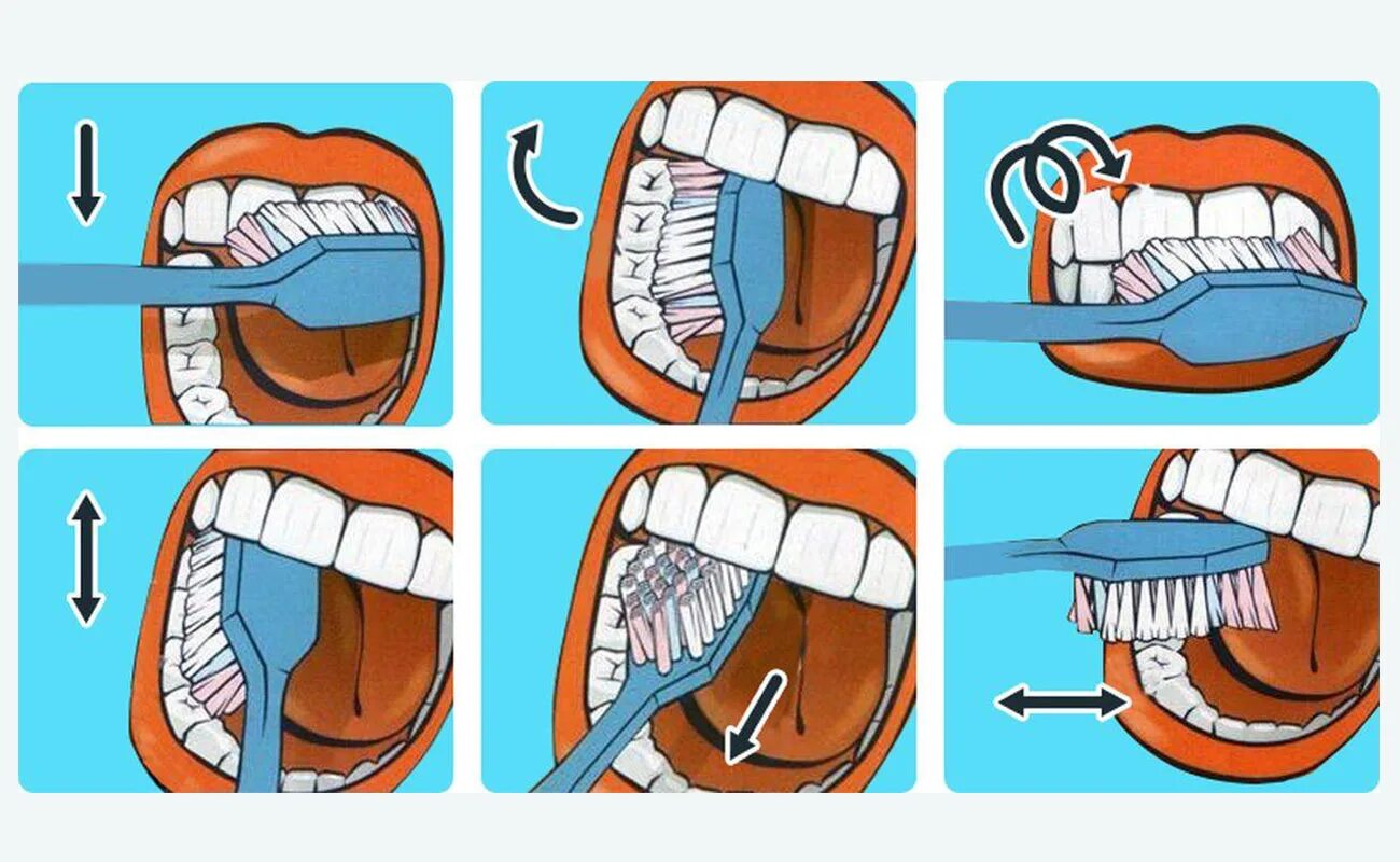 Когда лучше чистить зубы. Стандартный метод чистки зубов. Схема чистки зубов. Методы чистки зубов в стоматологии.