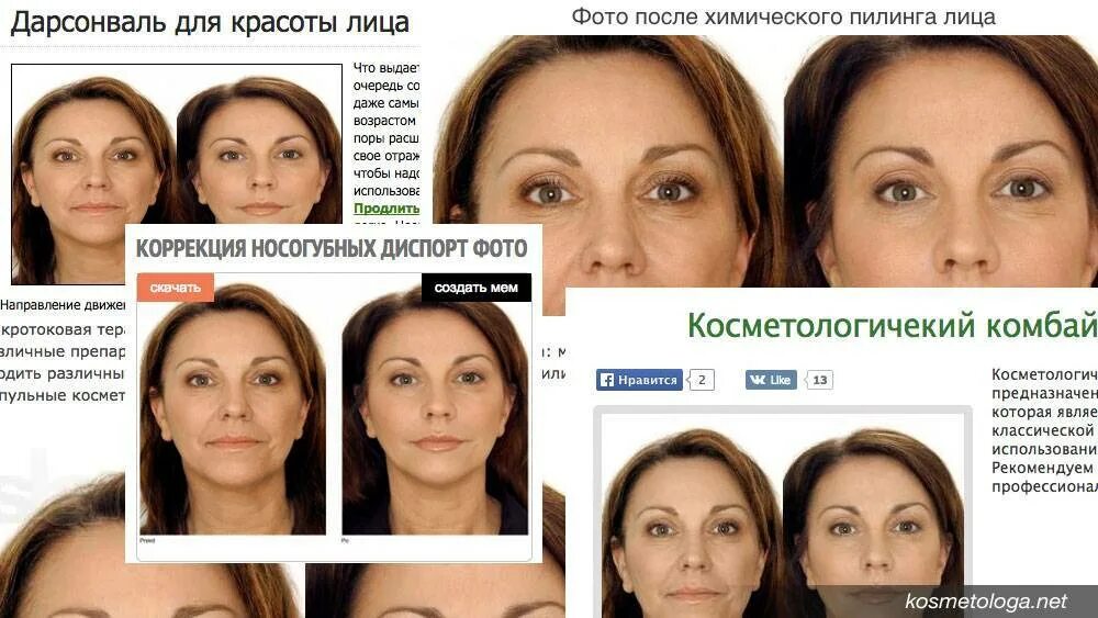 Дарсонваль: эффективное лечение от прыщей и угрей
