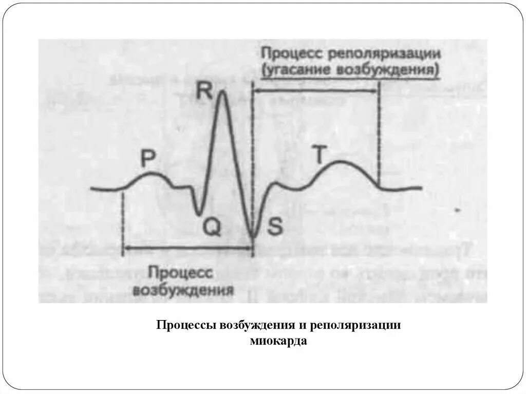 Умеренные изменения реполяризации