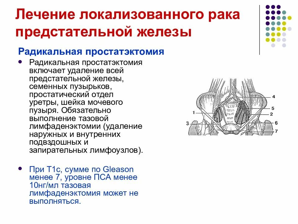 Предстательная железа рак лечится