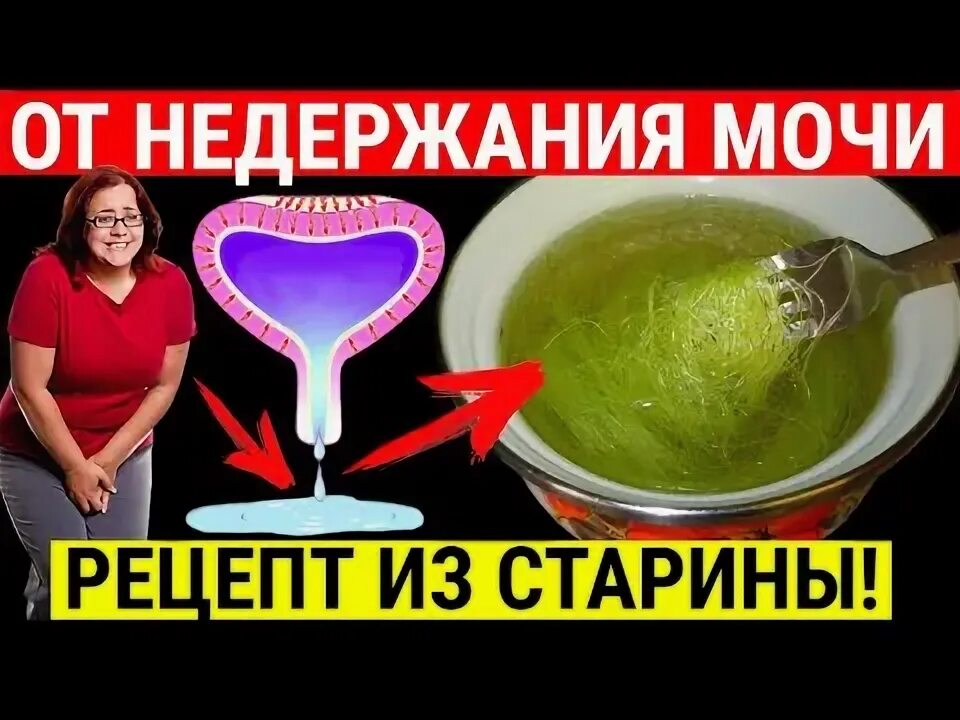 Недержание мочи у женщин после 50 лекарства. Недержание мочи у женщин после 50 лекарства. Недержание мочи у женщин после 50 лекарства. Типы стрессового недержания мочи. Стрессовое недержание мочи причины.