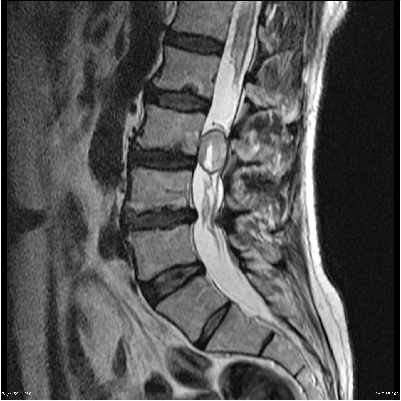 Pin on Lower Back Pain