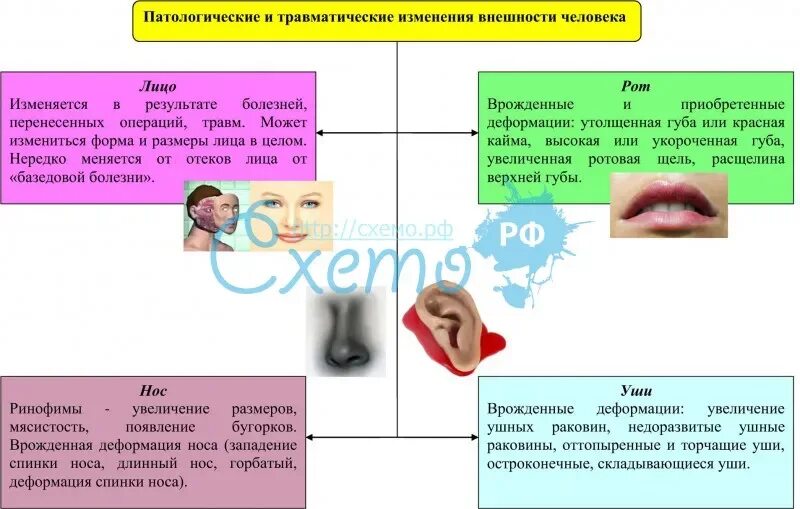 Болезни изменяющие облик человека. Патологические изменения внешности облика человека. Люди с модификацией внешности. Патологические изменения человека криминалистика.